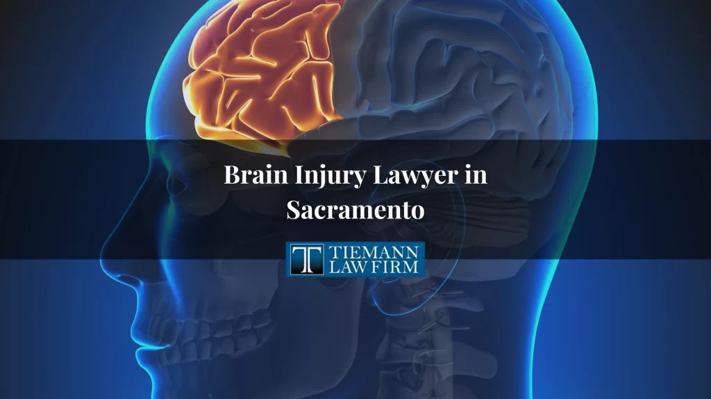 Brain Injury Lawyer in Northern California